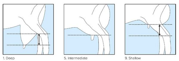 Section 5. Appendix 4. Figure 15: Udder Depth
